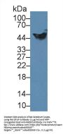 Glial Fibrillary Acidic Protein (GFAP) Antibody