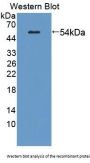 Glial Fibrillary Acidic Protein (GFAP) Antibody