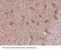 Glial Fibrillary Acidic Protein (GFAP) Antibody
