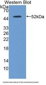 Inosine Triphosphatase (ITPA) Antibody