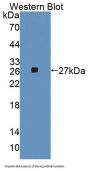 Aminoadipate Aminotransferase (AADAT) Antibody