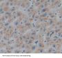Aminoadipate Aminotransferase (AADAT) Antibody