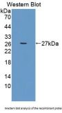 3-Ketodihydrosphingosine Reductase (KDSR) Antibody