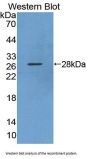 Karyopherin Alpha 3 (KPNa3) Antibody