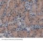 Laminin Beta 3 (LAMb3) Antibody