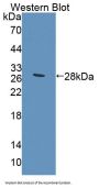 Fibronectin Leucine Rich Transmembrane Protein 2 (FLRT2) Antibody
