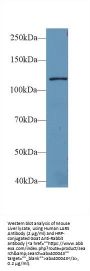 Leucyl tRNA Synthetase (LARS) Antibody
