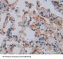 Leucyl tRNA Synthetase (LARS) Antibody
