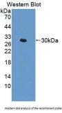 Arachidonate-12-Lipoxygenase, 12R Type (ALOX12B) Antibody