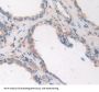 Arachidonate-12-Lipoxygenase, 12R Type (ALOX12B) Antibody