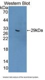 Methylcrotonoyl Coenzyme A Carboxylase 1 (MCCC1) Antibody