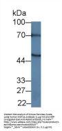 Myocyte Specific Enhancer Factor 2A (MEF2A) Antibody