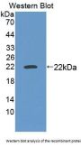 Myocyte Specific Enhancer Factor 2A (MEF2A) Antibody