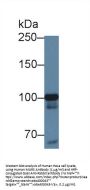 Methionyl tRNA Synthetase (MARS) Antibody