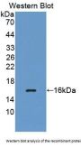 Methionyl tRNA Synthetase (MARS) Antibody