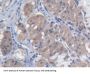Methionyl tRNA Synthetase (MARS) Antibody