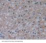 Methionyl tRNA Synthetase (MARS) Antibody