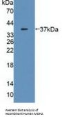 Malate Dehydrogenase 2 (MDH2) Antibody