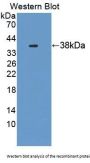 Ubiquitin Associated Protein 1 (UBAP1) Antibody