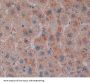 Sterol Carrier Protein 2 (SCP2) Antibody