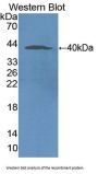Nicotinamide Adenine Dinucleotide Phosphate Oxidase 5 (NOX5) Antibody