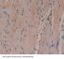 Progesterone Receptor (PGR) Antibody