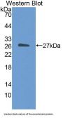 Germ Cell Nuclear Factor (GCNF) Antibody