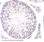 Germ Cell Nuclear Factor (GCNF) Antibody