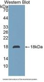 Transmembrane Protein 27 (TMEM27) Antibody