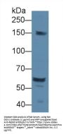 Docking Protein 1 (DOK1) Antibody