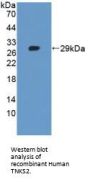 Tankyrase 2 (TNKS2) Antibody