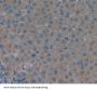 Tankyrase 2 (TNKS2) Antibody