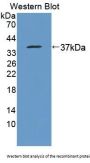 Pituitary Tumor Transforming 1 Interacting Protein (PTTG1IP) Antibody