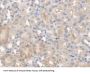 Pyridoxamine-5'-Phosphate Oxidase (PNPO) Antibody