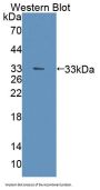 Phosphoglycerate Mutase 2, Muscle (PGAM2) Antibody