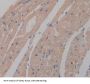 Phosphoglycerate Mutase 2, Muscle (PGAM2) Antibody