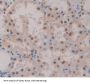 Polymerase DNA Directed Alpha 1 (POLa1) Antibody