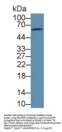 Pyruvate Dehydrogenase Phosphatase 2 (PDP2) Antibody