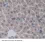 Pyruvate Dehydrogenase Phosphatase 2 (PDP2) Antibody