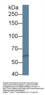 Protein Kinase D3 (PKD3) Antibody