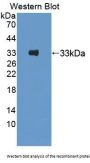 Protein Kinase D3 (PKD3) Antibody