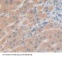 Protein Kinase D3 (PKD3) Antibody