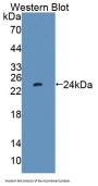 Protein Tyrosine Phosphatase Type IVA 1 (PTP4A1) Antibody