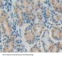 Protein Tyrosine Phosphatase Type IVA 1 (PTP4A1) Antibody