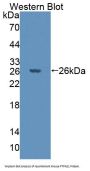 Protein Tyrosine Phosphatase, Non Receptor Type 21 (PTPN21) Antibody