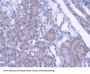 Protein Tyrosine Phosphatase, Non Receptor Type 21 (PTPN21) Antibody
