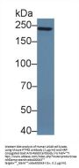 Protein Tyrosine Phosphatase Receptor Type Z (PTPRZ) Antibody