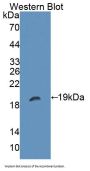 Protein Tyrosine Phosphatase Receptor Type Z (PTPRZ) Antibody