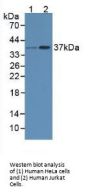 RAD51 Homolog (RAD51) Antibody