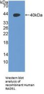 RAD51 Homolog (RAD51) Antibody